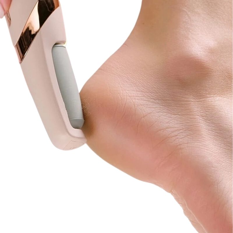 SmoothFeet Pro Electric Foot Callus Remover