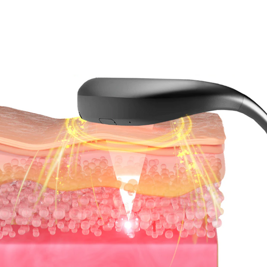 RejuvaSculpt™ Smart Electric Facial V-Shape Lifter