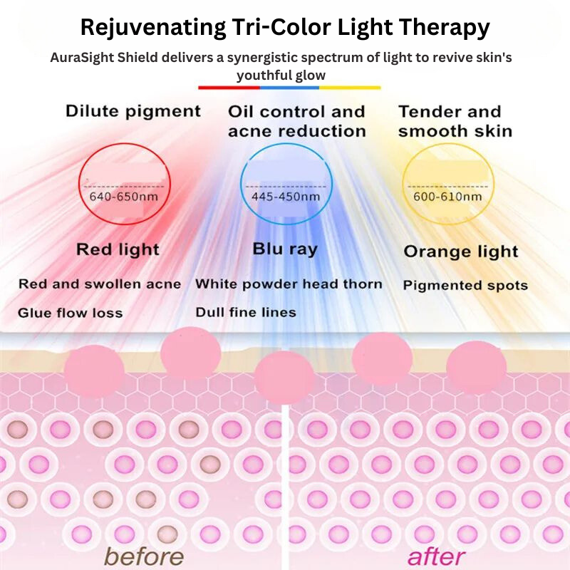 AuraSight Light Therapy Shield: Blemish Banisher
