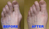 BodyWellness™-Comfy Orthotic Bunion Correcting Sandals-200001002-InspiredBeing