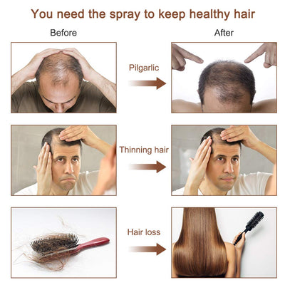 ActiveHair™ Hair Growth Spray , Ginger Hair Spray For Hair Growth