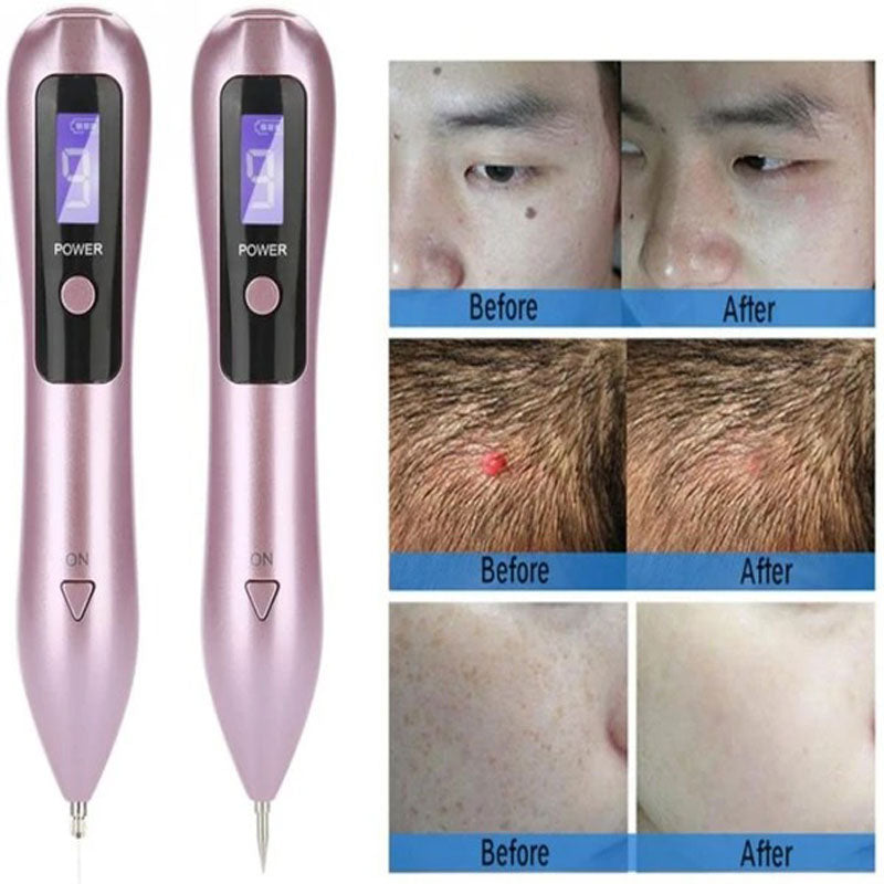 Plasma Pen Skin Tag & Mole Remover